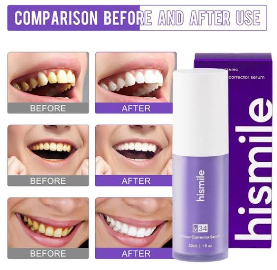 Hismile Teeth Whitening Gel (purple gel )